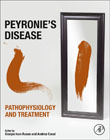 Peyronies Disease: Pathophysiology and Treatment