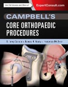 Campbells Top 100 Orthopaedic Procedures