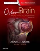 Osborns Brain