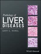 Pathology of Liver Diseases