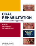 Oral rehabilitation: a case-based approach