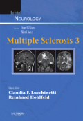 Multiple sclerosis 3