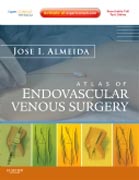 Atlas of endovascular venous surgery: expert consult - online and print