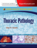 High-yield thoracic pathology: expert consult - online and print