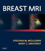 Breast MRI: Expert Consult: Online and Print