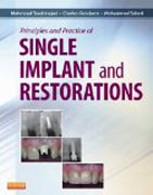 Principles and Practice of Single Implant and Restoration