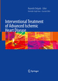 Interventional treatment of advanced ischemic heart disease