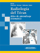 Radiología del tórax: atlas de aprendizaje sistemático