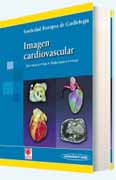 Imágen cardiovascular